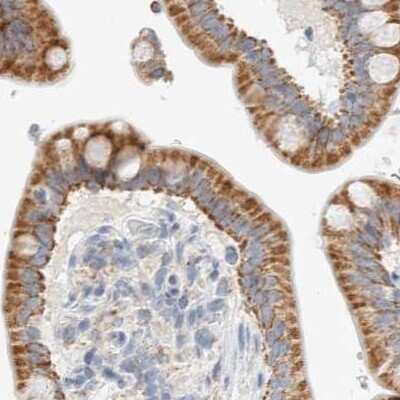 Immunohistochemistry-Paraffin: HDHD3 Antibody [NBP1-86707]