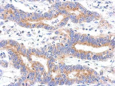 Immunohistochemistry-Paraffin: HDHD3 Antibody [NBP2-16798]