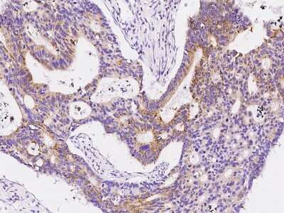 Immunohistochemistry-Paraffin: HDHD3 Antibody [NBP2-99145]