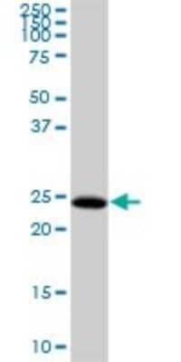 Western Blot: HDHD3 Antibody [H00081932-B01P]