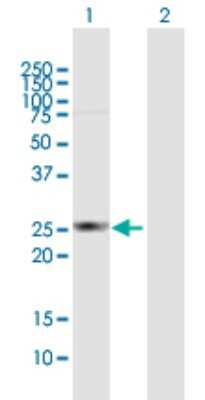 Western Blot: HDHD3 Antibody [H00081932-B01P]