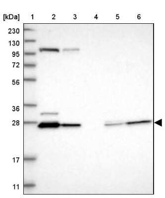 Western Blot: HDHD3 Antibody [NBP1-86706]