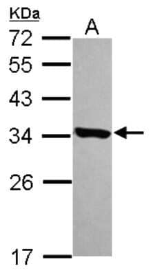 Western Blot: HDHD3 Antibody [NBP2-16798]