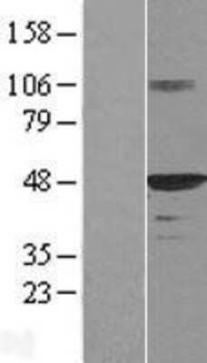 Western Blot: HDJ2 Overexpression Lysate [NBL1-09929]