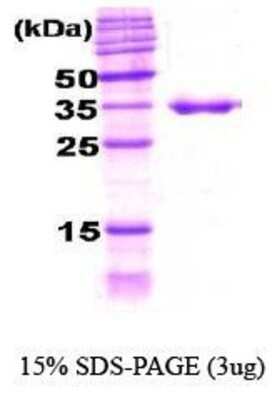 SDS-PAGE: Recombinant E. coli HDJ2 Protein [NBC1-18361]