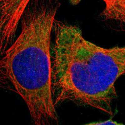 Immunocytochemistry/ Immunofluorescence: HDLBP Antibody [NBP1-83287]