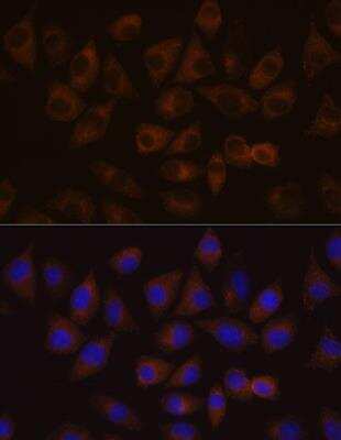Immunocytochemistry/ Immunofluorescence: HDLBP Antibody - Azide and BSA Free [NBP3-04382]