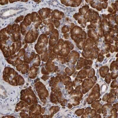 Immunohistochemistry-Paraffin: HDLBP Antibody [NBP1-83287]