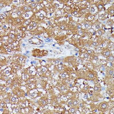 Immunohistochemistry-Paraffin: HDLBP Antibody - Azide and BSA Free [NBP3-04382]