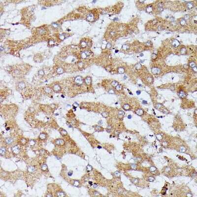Immunohistochemistry-Paraffin: HDLBP Antibody - Azide and BSA Free [NBP3-04382]