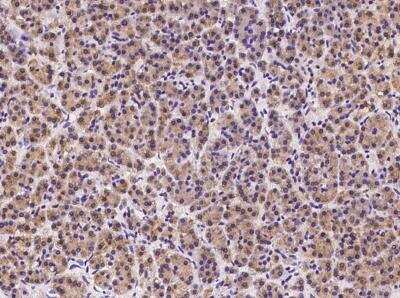 Immunohistochemistry-Paraffin: HDLBP Antibody [NBP3-05989]