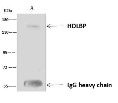Immunoprecipitation: HDLBP Antibody [NBP3-05989]