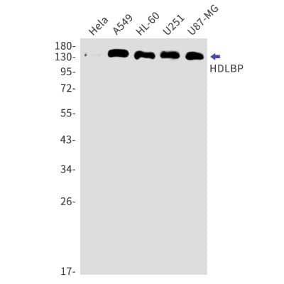 Western Blot: HDLBP Antibody (S07-3H2) [NBP3-19872]