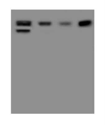 Western Blot: HDLBP Antibody [NBP3-05989]