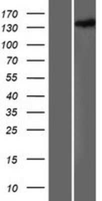 Western Blot: HDLBP Overexpression Lysate [NBP2-07762]