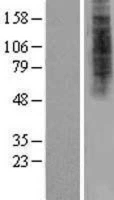 Western Blot: HDX Overexpression Lysate [NBP2-05541]