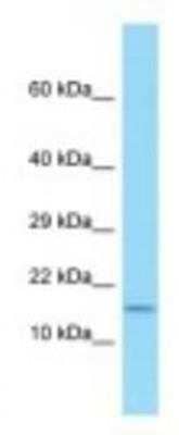 Western Blot: HE2 Antibody [NBP1-98296]