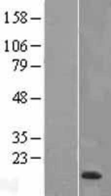 Western Blot: HE4/WFDC2 Overexpression Lysate [NBL1-17841]