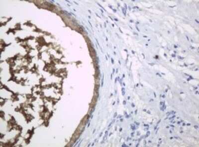 Immunohistochemistry: HE4/WFDC2 Antibody (OTI1E12) [NBP2-46360]