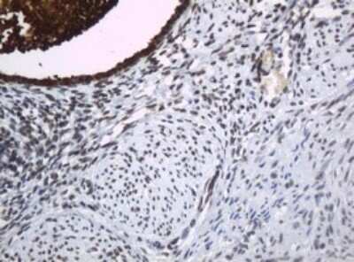 Immunohistochemistry: HE4/WFDC2 Antibody (OTI1E12) [NBP2-46360]