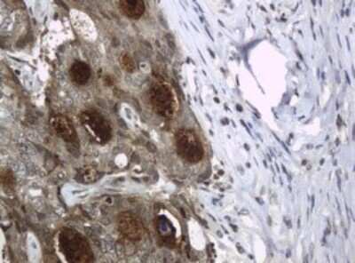 Immunohistochemistry: HE4/WFDC2 Antibody (OTI1E12) [NBP2-46360]
