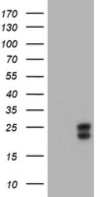 Western Blot: HE4/WFDC2 Antibody (OTI1E12) [NBP2-46360]