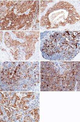 Immunohistochemistry-Paraffin: HE4/WFDC2 Antibody (404) [NBP2-90132]