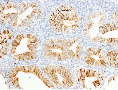 Immunohistochemistry-Paraffin: HE4/WFDC2 Antibody (404) [NBP2-90132]