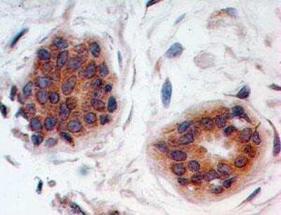 Immunohistochemistry-Paraffin: HE4/WFDC2 Antibody [NBP2-27299]