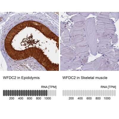 Immunohistochemistry-Paraffin: HE4/WFDC2 Antibody [NBP2-48762]