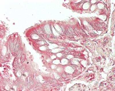 Immunohistochemistry-Paraffin: HE4/WFDC2 Antibody [NBP2-69988]