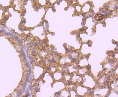 Immunohistochemistry-Paraffin: HE4/WFDC2 Antibody (JF62-09) [NBP2-66883]