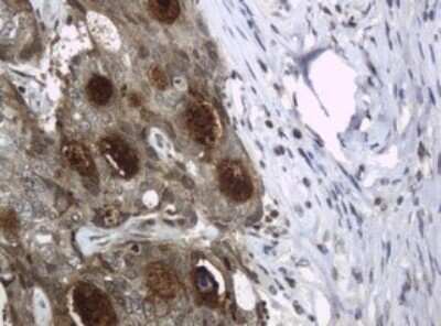 Immunohistochemistry: HE4/WFDC2 Antibody (OTI1E12) - Azide and BSA Free [NBP2-71599]