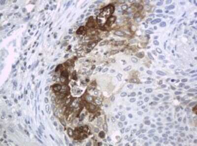 Immunohistochemistry: HE4/WFDC2 Antibody (OTI1E12) - Azide and BSA Free [NBP2-71599]