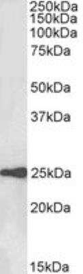 Western Blot: HE4/WFDC2 Antibody [NBP1-49888]