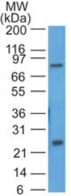 Western Blot: HE4/WFDC2 Antibody [NBP2-27299]