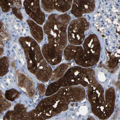 Immunohistochemistry-Paraffin: HEATR2 Antibody [NBP1-82183]