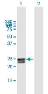 Western Blot: HEATR2 Antibody [H00054919-B01P]