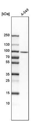 Western Blot: HEATR2 Antibody [NBP1-82183]