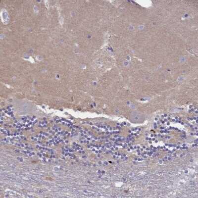 Immunohistochemistry-Paraffin: HEATR3 Antibody [NBP1-93966]
