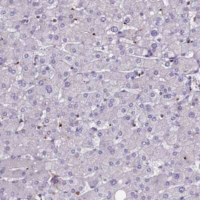 Immunohistochemistry-Paraffin: HEATR3 Antibody [NBP1-93966]