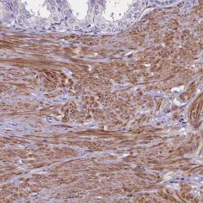 Immunohistochemistry-Paraffin: HEATR3 Antibody [NBP1-93966]