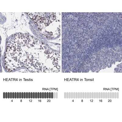 Immunocytochemistry/ Immunofluorescence: HEATR4 Antibody [NBP3-17126]