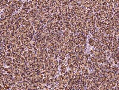 Immunohistochemistry-Paraffin: HEATR4 Antibody [NBP3-05832]