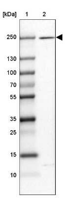 Western Blot: HEATR5A Antibody [NBP2-14685]