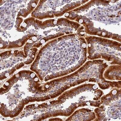 Immunohistochemistry-Paraffin: HEATR5B Antibody [NBP1-94067]