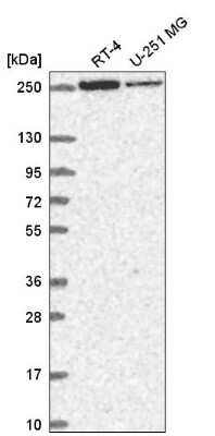 Western Blot: HEATR5B Antibody [NBP2-55762]