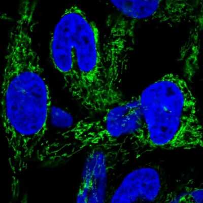 Immunocytochemistry/ Immunofluorescence: HEATR6 Antibody [NBP2-55759]