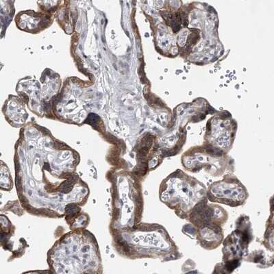 Immunohistochemistry-Paraffin: HEATR6 Antibody [NBP1-90877]