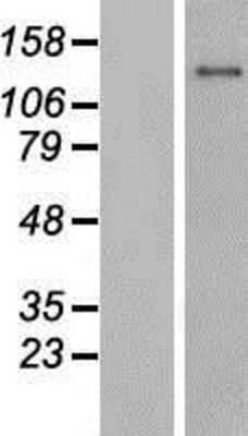 Western Blot: HEATR6 Overexpression Lysate [NBP2-06473]